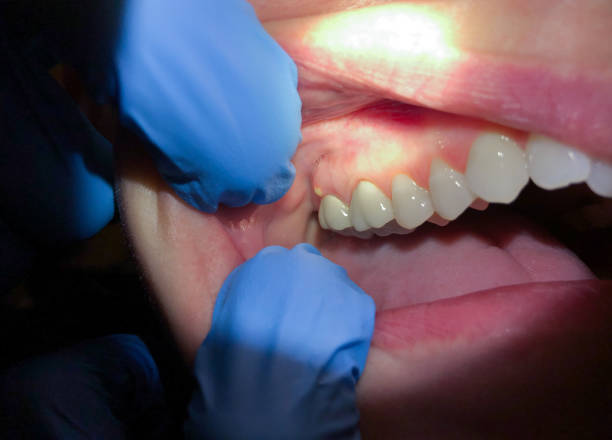 Best Emergency Gum Pain Relief  in Pawhuska, OK