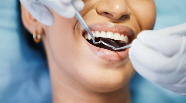 Best Chipped Tooth Repair Near Me  in Pawhuska, OK