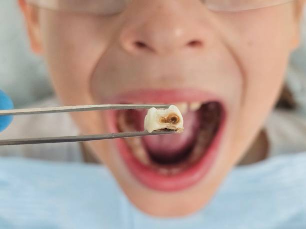 Best Cracked Tooth Emergency Dentist  in Pawhuska, OK